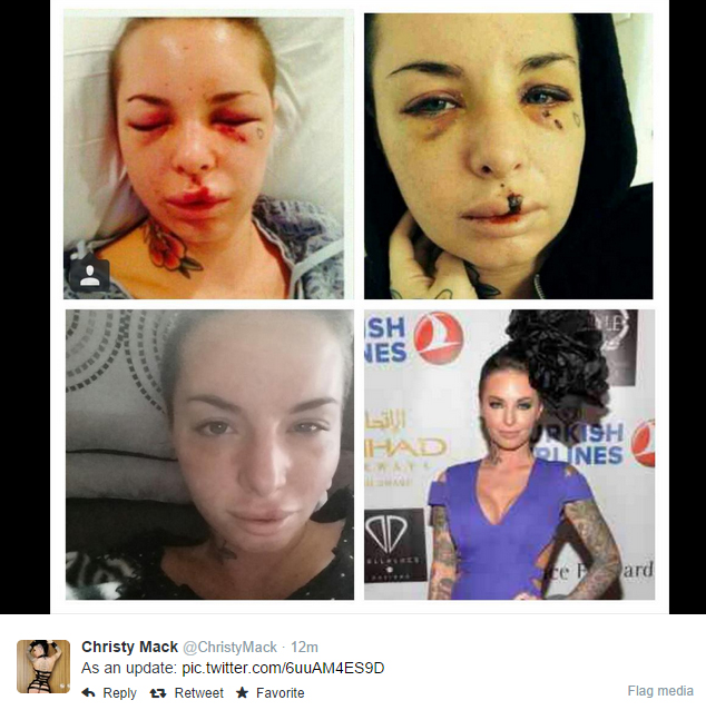 Christy Mack Before and After: What Really Happened? (See How)