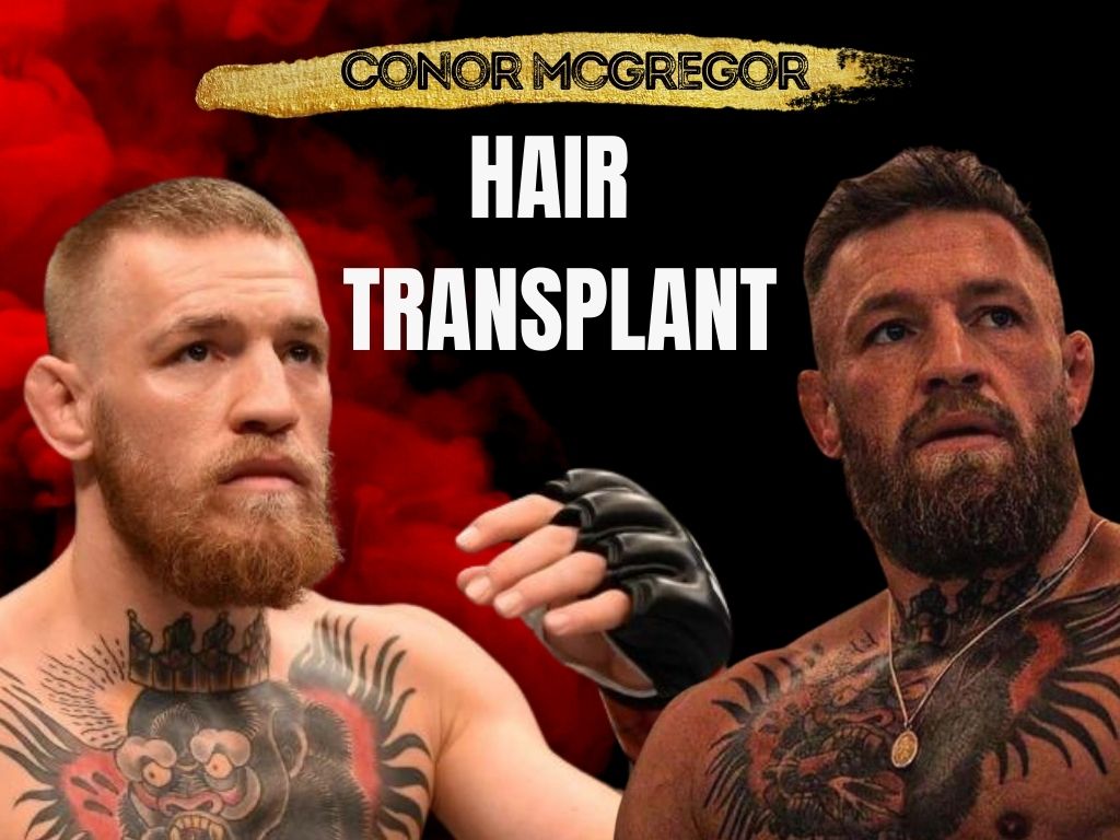 Conor McGregor Hair: Get the UFC Stars Hairstyle Secrets!