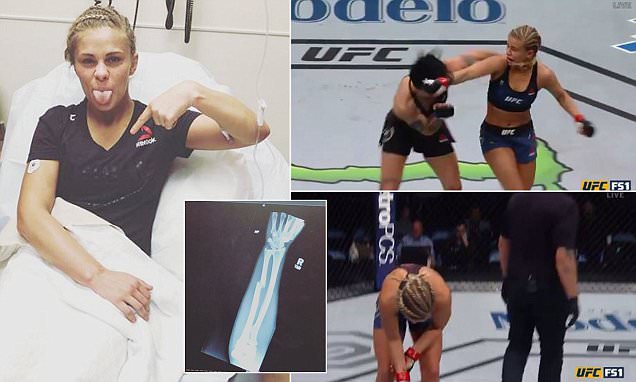 Paige VanZant Breaks Her Arm: See the Shocking Injury Details and Updates!